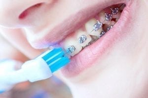 Orthodontist in Chattanooga, TN | Affordable Smiles